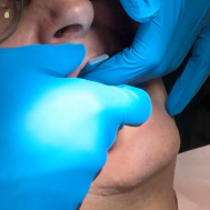 bloger thumb1